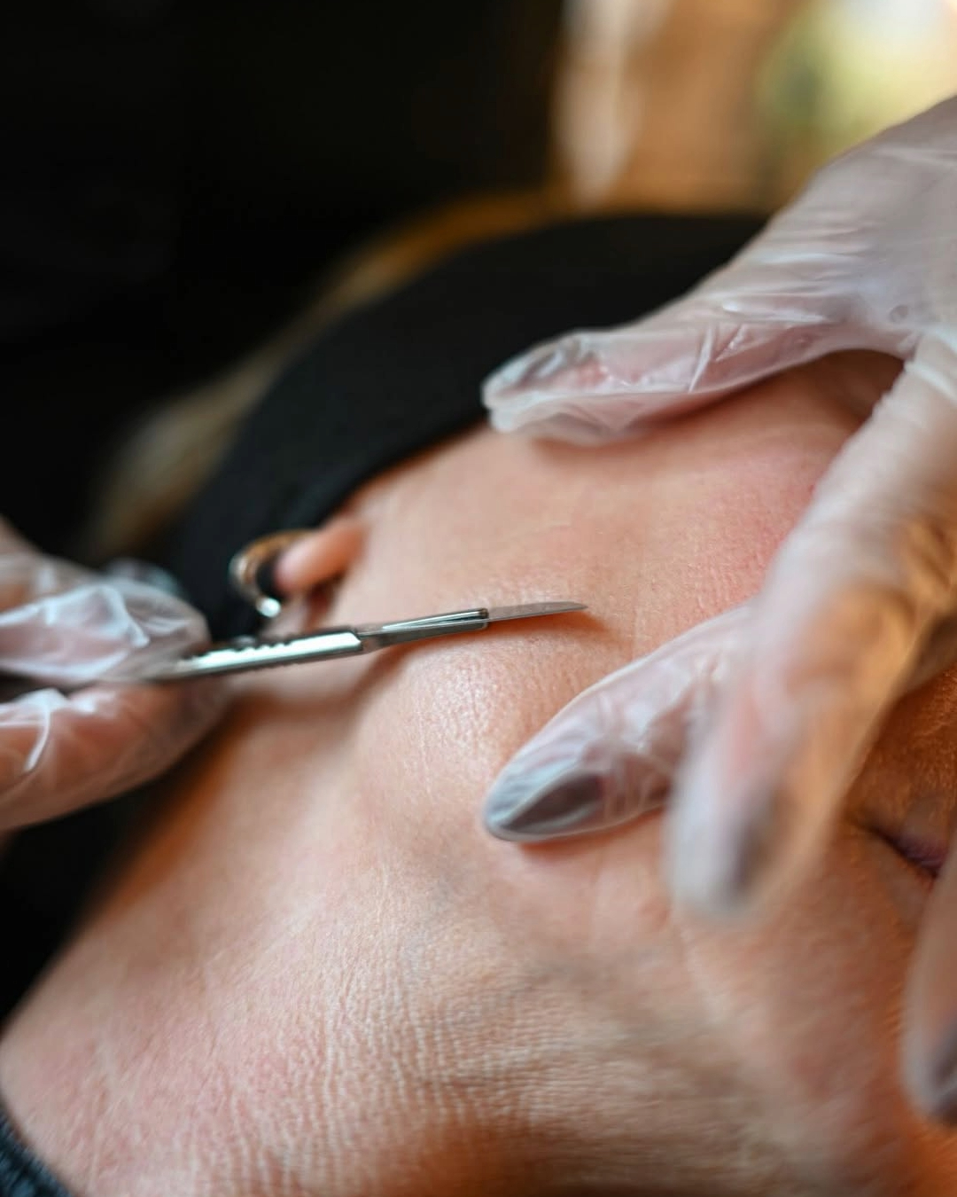 Dermaplaning near me 